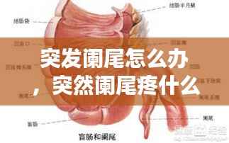 突发阑尾怎么办,突然阑尾疼什么原因