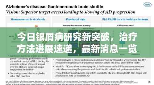 今日银屑病研究新突破,治疗方法进展速递,最新消息一览
