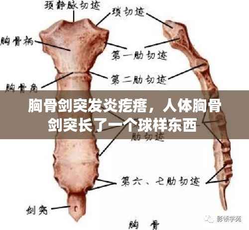 胸骨剑突发炎疙瘩,人体胸骨剑突长了一个球样东西