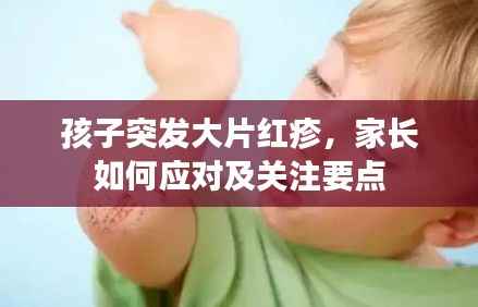 孩子突发大片红疹，家长如何应对及关注要点