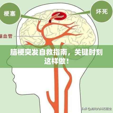 脑梗突发自救指南,关键时刻这样做!
