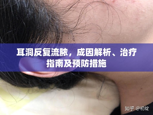 耳洞反复流脓，成因解析、治疗指南及预防措施