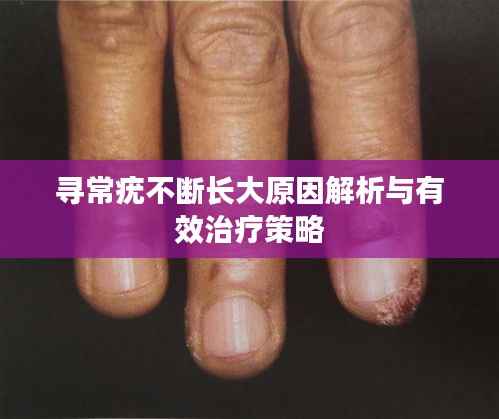 寻常疣不断长大原因解析与有效治疗策略